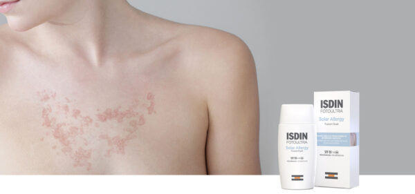 ضدآفتاب فلوئید سولار آلرژی SPF100 ایزدین | محافظت قوی در برابر اشعه و آلرژی به خورشید - Image 6