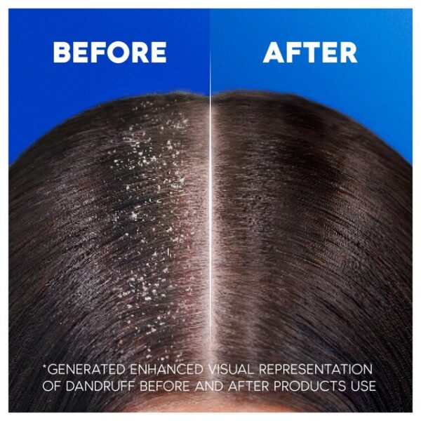 شامپو ضدشوره با رایحه گل هد اند شولدرز مدل Smooth & Silky - Image 2